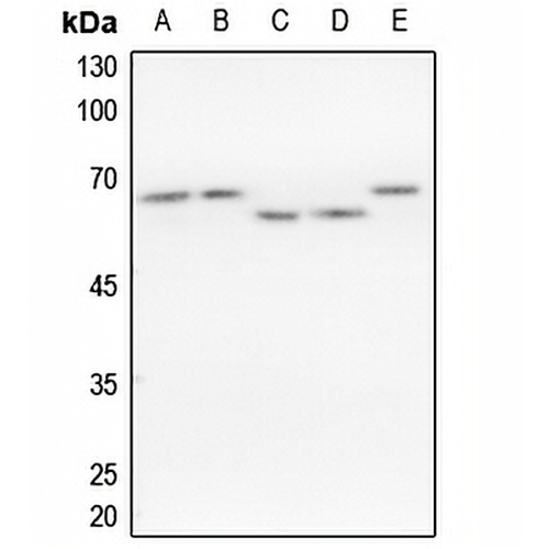 hnRNP K Rabbit Polyclonal Antibody