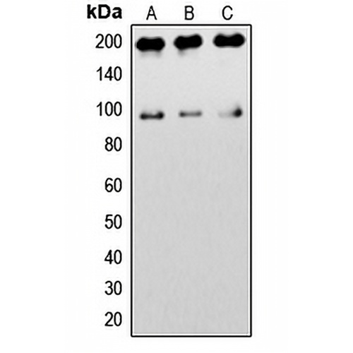 IGF1 Receptor Rabbit Polyclonal Antibody