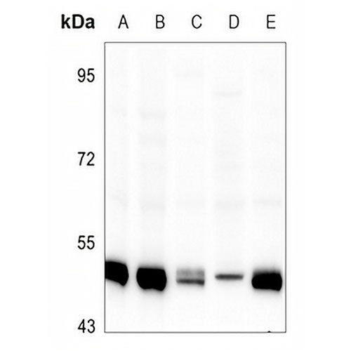 IKK gamma Rabbit Polyclonal Antibody