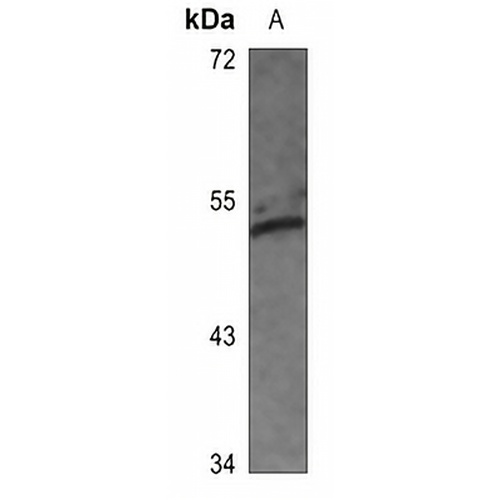 c-Jun (Phospho-S63) Rabbit Polyclonal Antibody