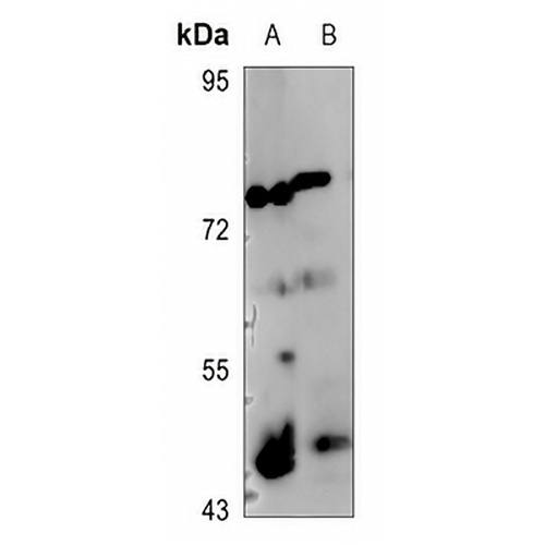 c-Jun (Phospho-S73/100) Rabbit Polyclonal Antibody