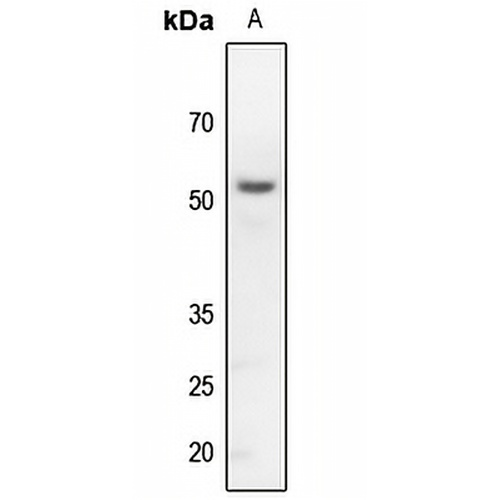 Kir3.1 Rabbit Polyclonal Antibody
