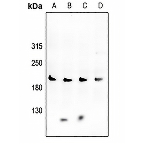 VEGFR2 Rabbit Polyclonal Antibody