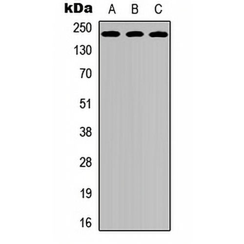 VEGFR2 Rabbit Polyclonal Antibody