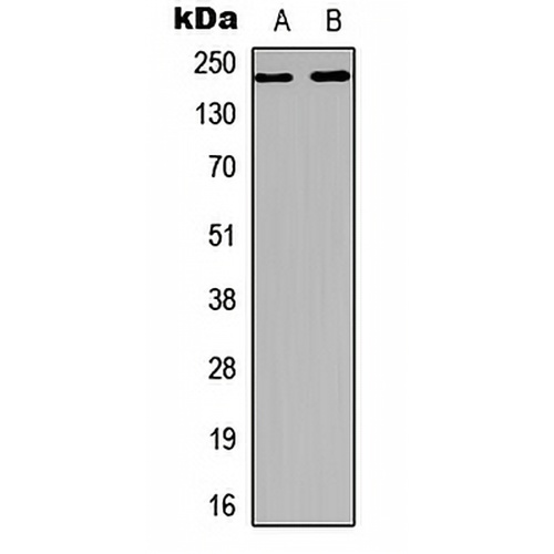 VEGFR2 Rabbit Polyclonal Antibody