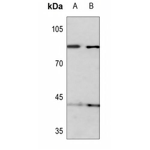 KIF2C (Phospho-S95) Rabbit Polyclonal Antibody