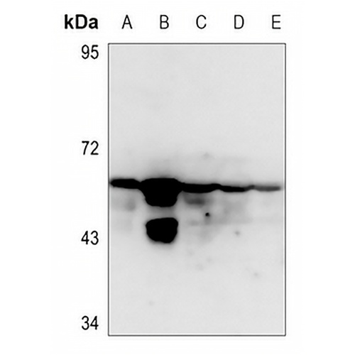 Cytokeratin 8 (Phospho-S432) Rabbit Polyclonal Antibody