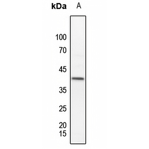 MKK3 (Phospho-T222) Rabbit Polyclonal Antibody