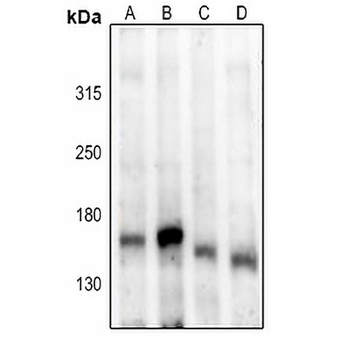 ASK1 (Phospho-S83) Rabbit Polyclonal Antibody