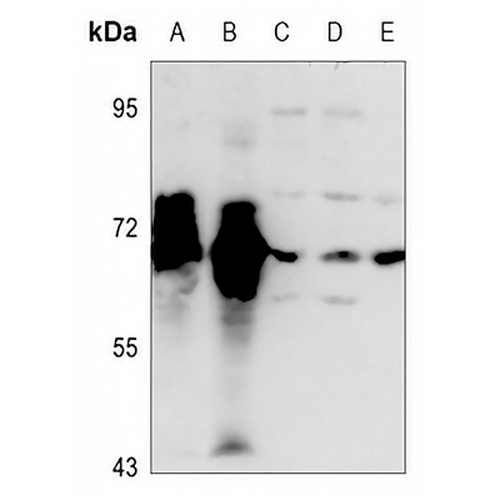TAU Rabbit Polyclonal Antibody