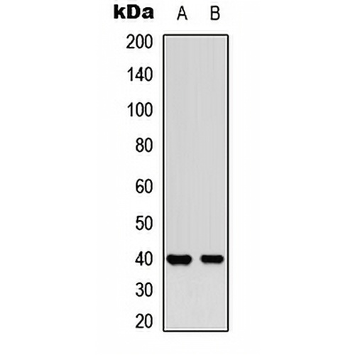 MCL1 (Phospho-S159) Rabbit Polyclonal Antibody