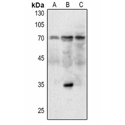 MDM2 Rabbit Polyclonal Antibody