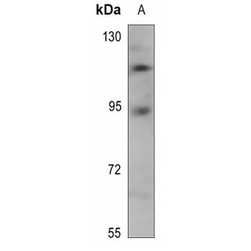TRAP100 Rabbit Polyclonal Antibody
