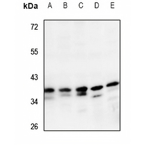 CRSP8 Rabbit Polyclonal Antibody