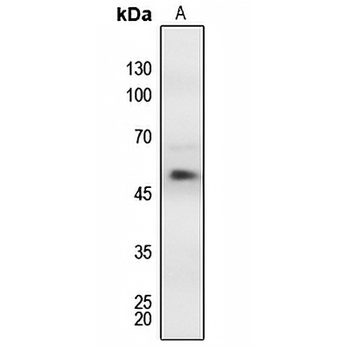 MEF2A (Phospho-T312) Rabbit Polyclonal Antibody