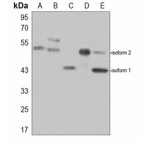 MEIS1 Rabbit Polyclonal Antibody