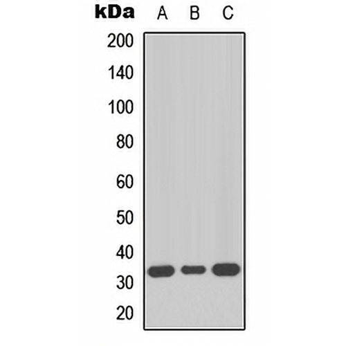 MKI67IP Rabbit Polyclonal Antibody
