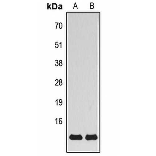 MRPS21 Rabbit Polyclonal Antibody