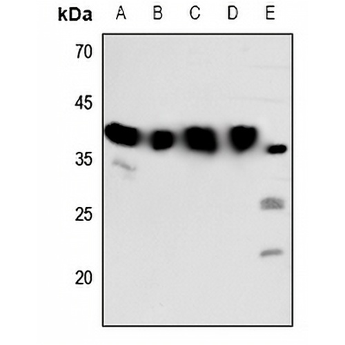 Melatonin Receptor 1b Rabbit Polyclonal Antibody