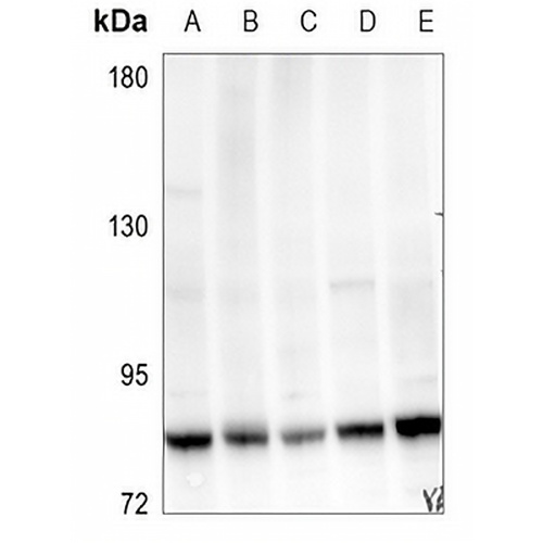 MYBL2 Rabbit Polyclonal Antibody