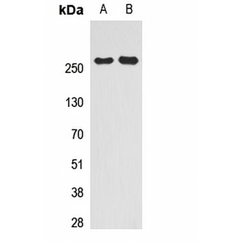 SMRT Rabbit Polyclonal Antibody