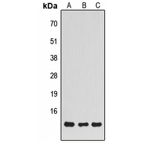 NDUFS5 Rabbit Polyclonal Antibody