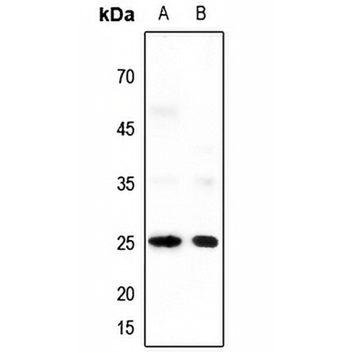 Neuromedin U Rabbit Polyclonal Antibody