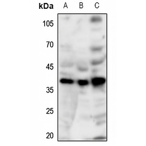 GPR86 Rabbit Polyclonal Antibody