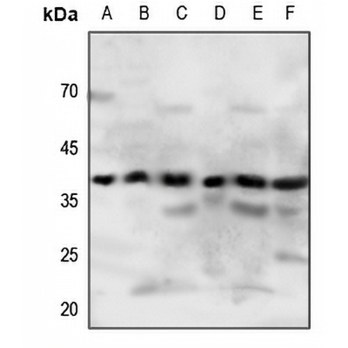 P2Y4 Rabbit Polyclonal Antibody
