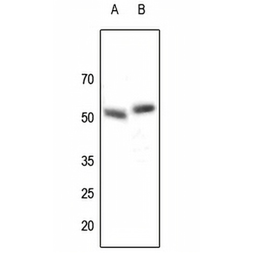 Parkin Rabbit Polyclonal Antibody