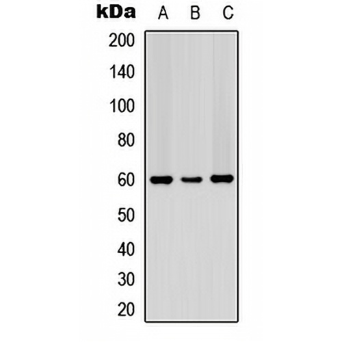 PDCD4 (Phospho-S67) Rabbit Polyclonal Antibody