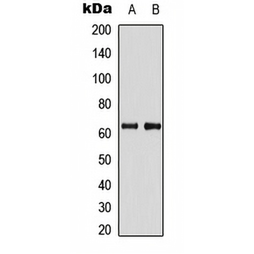 PDPK1 Rabbit Polyclonal Antibody