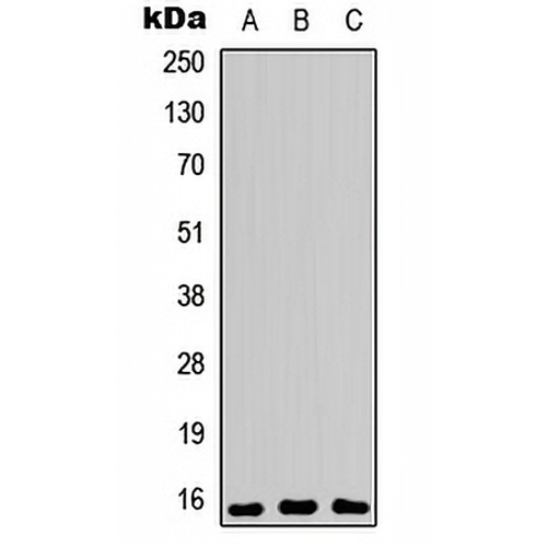 PEA15 (Phospho-S104) Rabbit Polyclonal Antibody