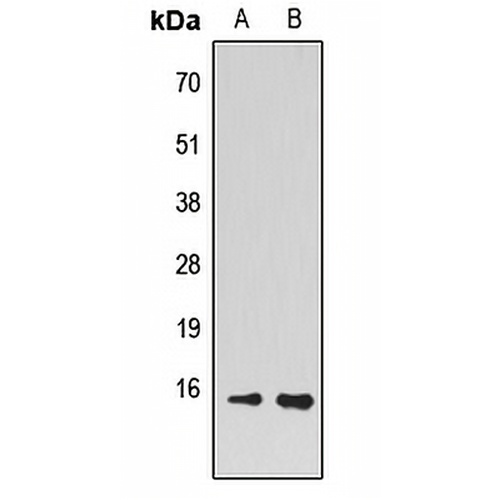 PEA15 Rabbit Polyclonal Antibody