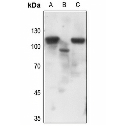 Progesterone Receptor (Phospho-S190) Rabbit Polyclonal Antibody