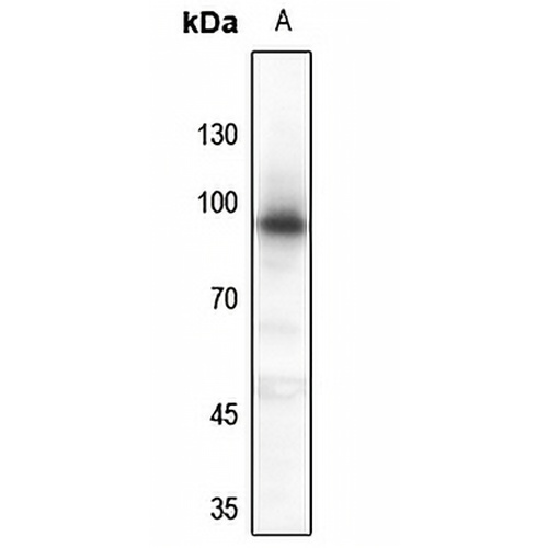 Progesterone Receptor Rabbit Polyclonal Antibody