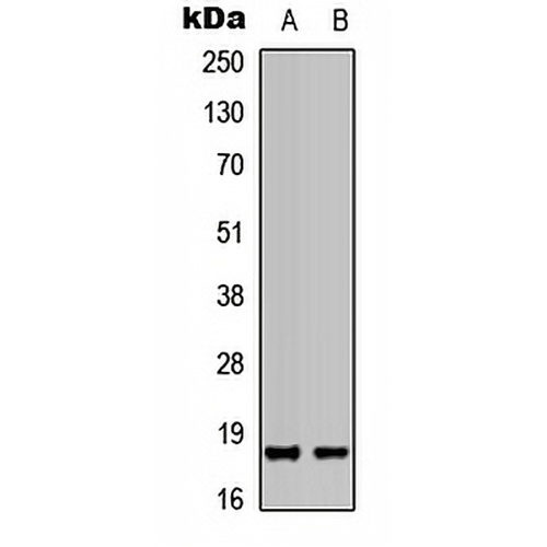 PIN1 Rabbit Polyclonal Antibody