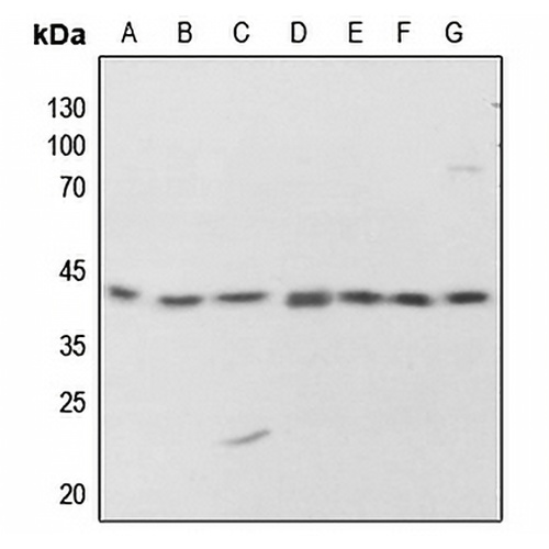 PKA C alpha/beta/gamma (Phospho-T198) Rabbit Polyclonal Antibody