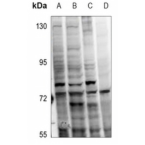 PKC alpha (Phospho-T638) Rabbit Polyclonal Antibody