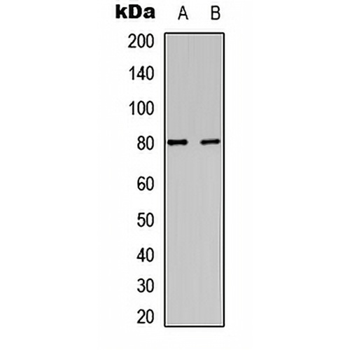 PKC alpha (Phospho-Y658) Rabbit Polyclonal Antibody