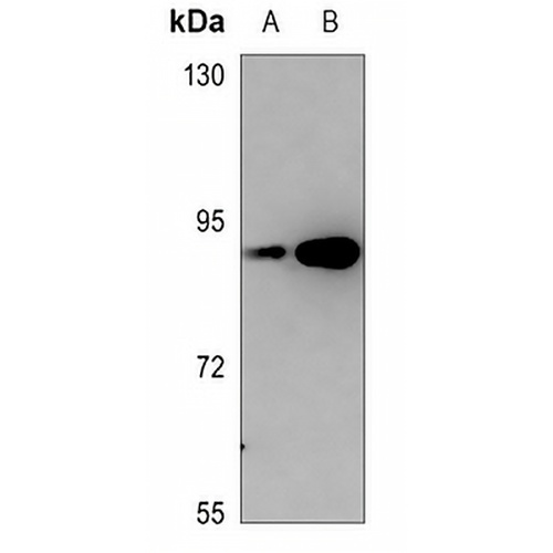 PKC epsilon (Phospho-S729) Rabbit Polyclonal Antibody