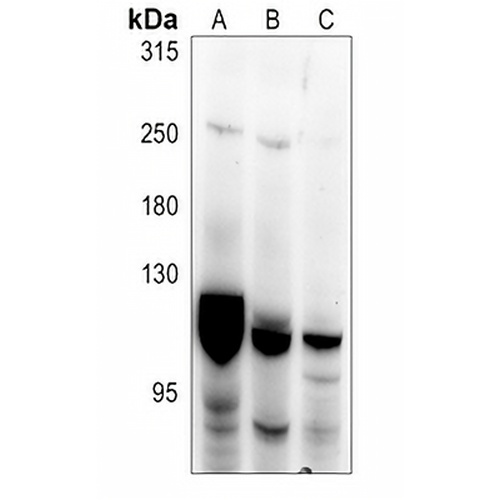 PKC mu Rabbit Polyclonal Antibody