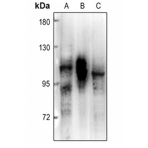 PRKD2 Rabbit Polyclonal Antibody