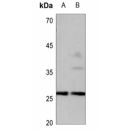CD201 Rabbit Polyclonal Antibody