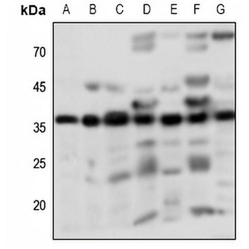 PGD2 Receptor Rabbit Polyclonal Antibody