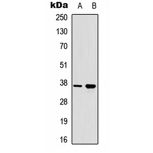RAD51A (Phospho-Y315) Rabbit Polyclonal Antibody