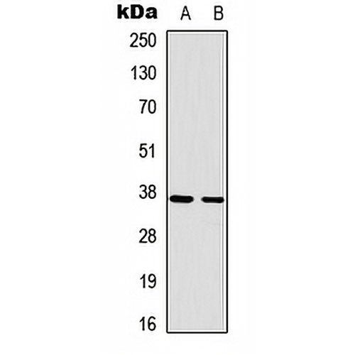RAD51A Rabbit Polyclonal Antibody