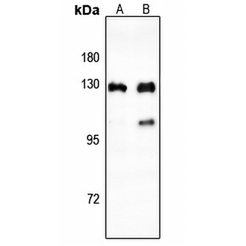 CTIP Rabbit Polyclonal Antibody