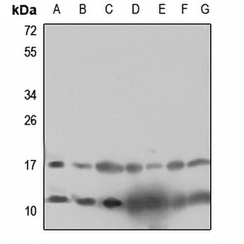 RPL12 Rabbit Polyclonal Antibody