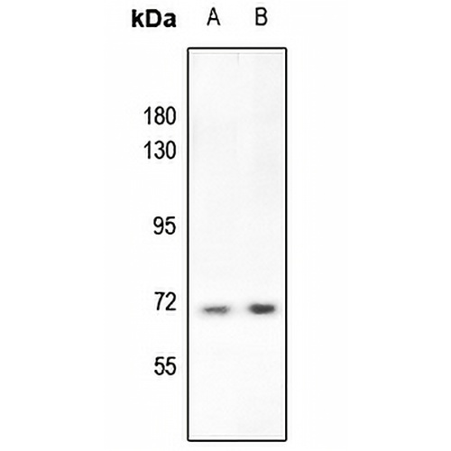 S6K1 (Phospho-T412) Rabbit Polyclonal Antibody